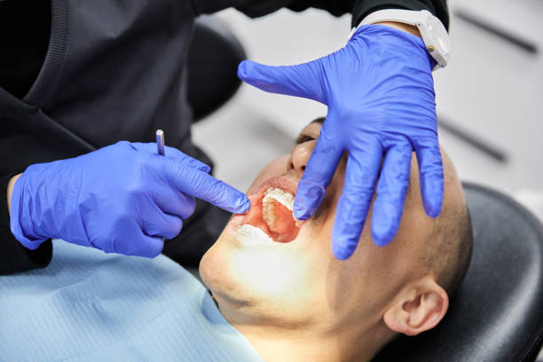 Best Emergency Dentist for Knocked-Out Tooth in Grant Valkaria, FL